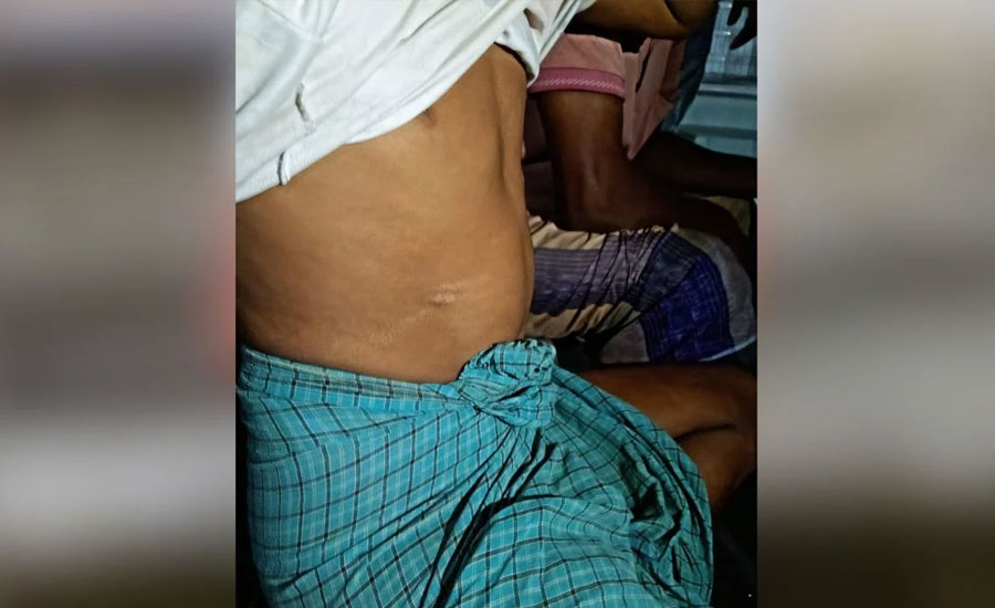 চুল কাটতে বের হওয়া রায়হান ফিরল এক পা ও কিডনি হারিয়ে   