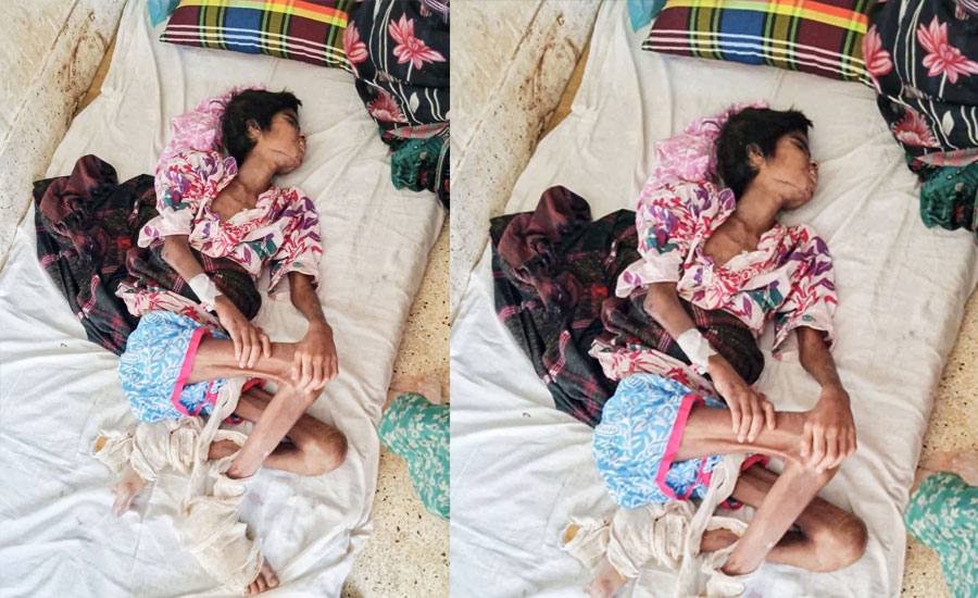 গরম খুন্তির ছ্যাঁকায় ক্ষতবিক্ষত ১১ বছরের তানিয়া, হাসপাতালে মৃত্যুর সঙ্গে লড়াই