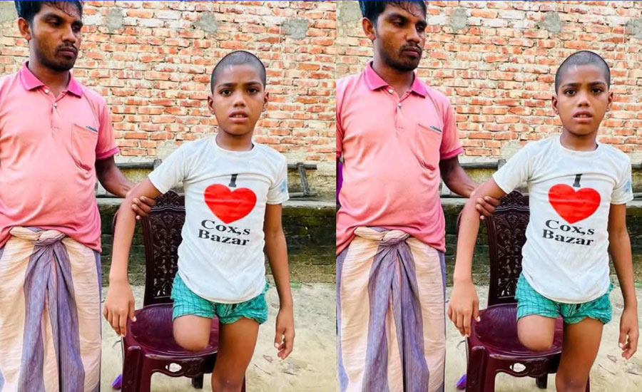 শিশু রায়হানের পা কাটা নিয়ে বেরিয়ে এলো চাঞ্চল্যকর তথ্য