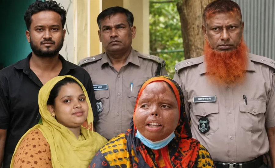 গরম ডাল ছুড়ে স্ত্রীর মুখ ঝলসানোর পর তালাক, মামলায় স্বামী কারাগারে