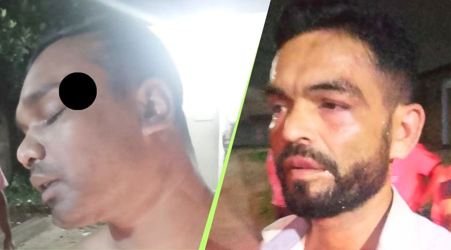 সিইউএফএলে ট্রাক সরানো নিয়ে আনসার-চালক সংঘর্ষ, আহত ২