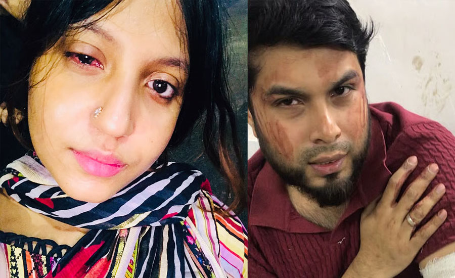 দম্পতিকে কুপিয়ে জখমের অভিযোগ, মামলা নেয়নি পুলিশ