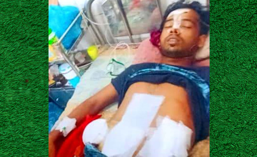 দুর্গাপুরে টাকা ধার নিয়ে বিরোধ, তিনজনকে কুপিয়ে পিটিয়ে জখম পাঁচজনের বিরুদ্ধে মামলা