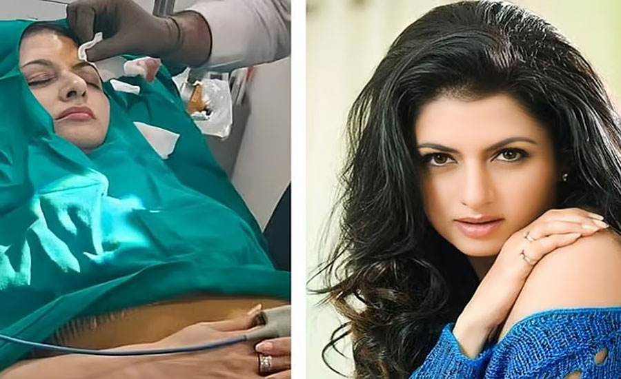 কপালে ১৩টি সেলাই, কী হয়েছিল সালমানের নায়িকা ভাগ্যশ্রীর