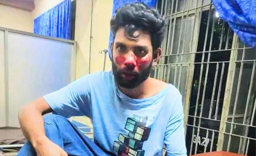 চবির নারী শিক্ষার্থীকে উত্যক্তের জেরে মারধরের ঘটনায় আহত ১