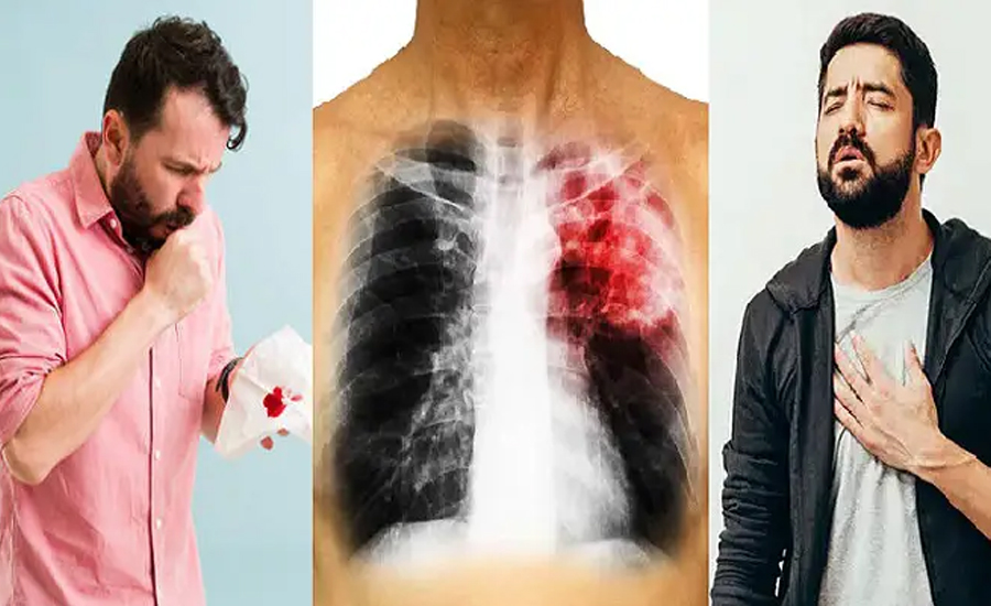 যেসব কারণে ক্ষতিগ্রস্ত হতে পারে ফুসফুস