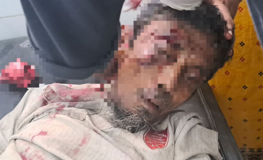 পাইকগাছায় সড়ক দুর্ঘটনায় ভিক্ষুকের মৃত্যু