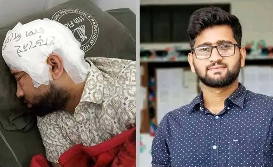 ফ্রিজে রাখা খুলি দুই মাস পর লাগানো হলো মামুনের মাথায়