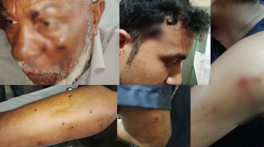 পদ্মা নদীতে টহলরত নৌ পুলিশের ওপর হামলা, ওসিসহ ৫ সদস্য গুলিবিদ্ধ পদ্মা নদীতে টহলরত নৌ পুলিশের ওপর হামলা, ওসিসহ ৫ সদস্য গুলিবিদ্ধ